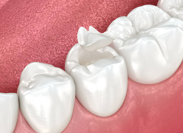 Oral Surgery in Cedar Knolls, NJ